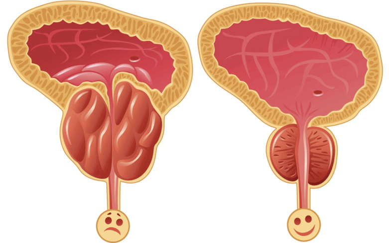 potences problēmu cēloņi vīriešiem